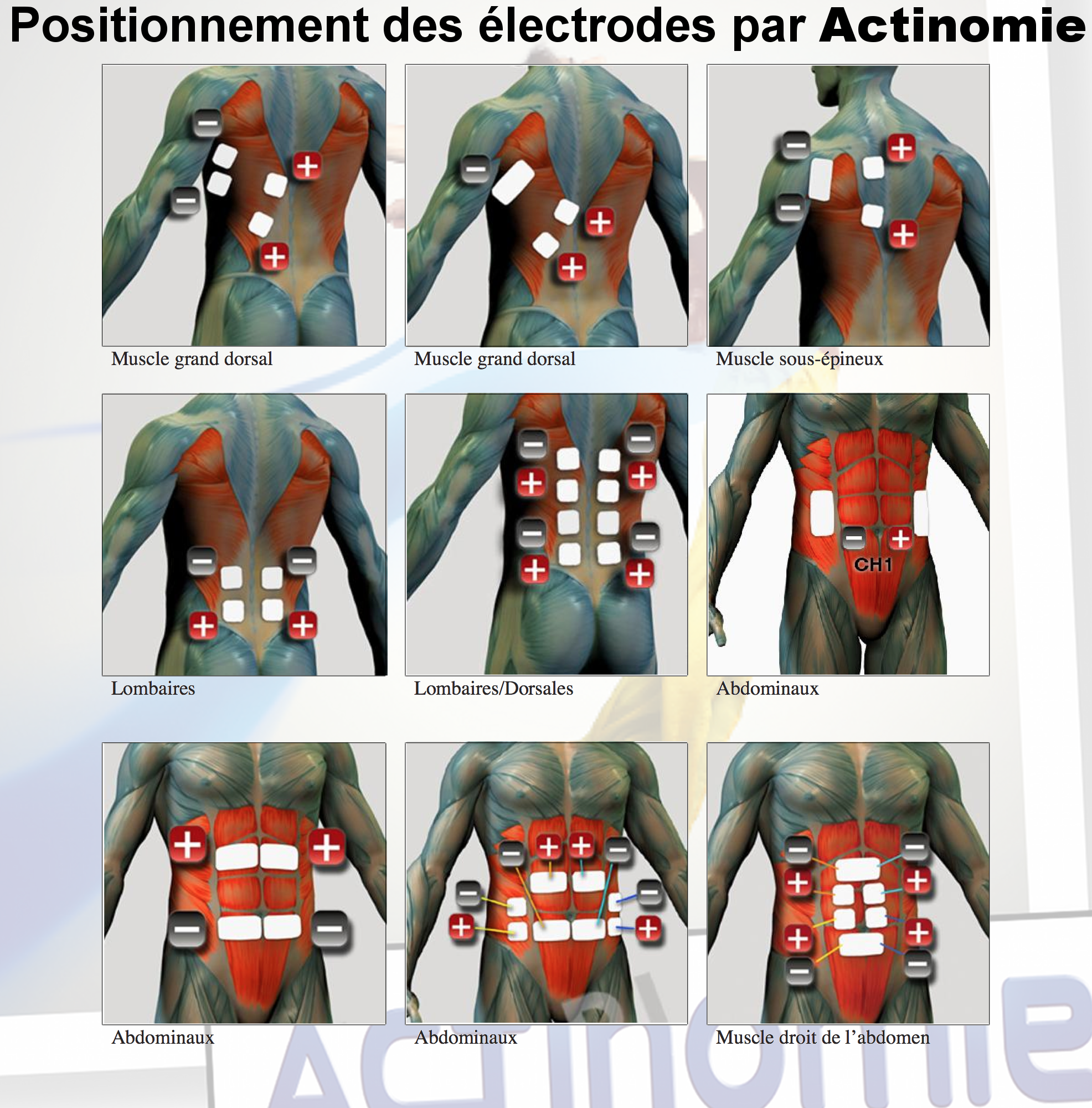 abdos electrodes